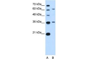 WB Suggested Anti-ZSCAN12 Antibody Titration:  5. (ZSCAN12 抗体  (N-Term))