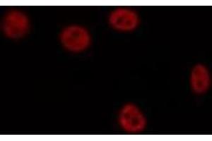 ABIN6275887 staining HepG2 by IF/ICC. (LHX1 抗体  (Internal Region))