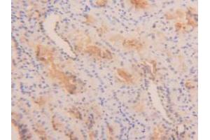 Figure. (TPSAB1 抗体  (AA 161-262))