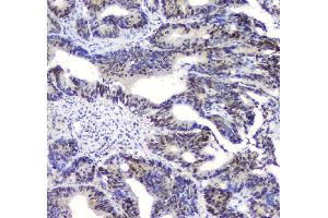 IHC analysis of SQSTM1 using anti-SQSTM1 antibody (ABIN3043937).