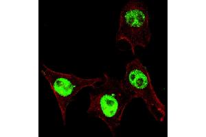 Fluorescent confocal ige of HeLa cells stained with phospho-SD3- antibody. (SMAD3 抗体  (pSer208))