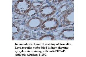 Image no. 1 for anti-CD2-Associated Protein (Cd2ap) (C-Term) antibody (ABIN791046) (CD2AP 抗体  (C-Term))