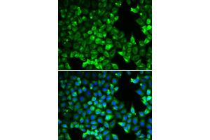 Immunofluorescence analysis of U2OS cell using PDLIM5 antibody. (PDLIM5 抗体)