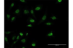 Immunofluorescence of purified MaxPab antibody to HMGA1 on HeLa cell. (HMGA1 抗体  (AA 1-107))