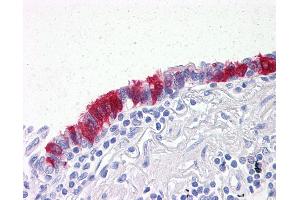 Anti-ARVCF antibody IHC of human lung, respiratory epithelium. (ARVCF 抗体  (AA 863-963))