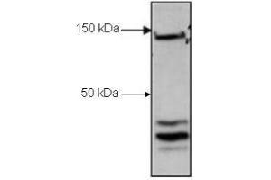 Western Blot of Rabbit Anti-CTCF antibody. (CTCF 抗体  (C-Term))