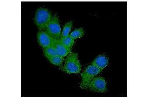IF analysis of FHIT using anti-FHIT antibody (ABIN5693307). (FHIT 抗体  (AA 1-147))
