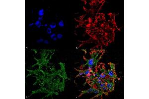 Immunocytochemistry/Immunofluorescence analysis using Mouse Anti-GABA-B Receptor 1 Monoclonal Antibody, Clone S93A-49 (ABIN1027717). (GABBR1 抗体  (AA 873-977))