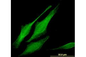 Immunofluorescence of monoclonal antibody to MORG1 on HeLa cell. (MORG1 抗体  (AA 171-262))