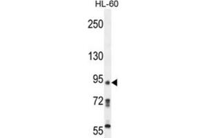 Western Blotting (WB) image for anti-KRI1 Homolog (KRI1) antibody (ABIN5015220) (KRI1 抗体)