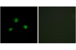 Immunofluorescence analysis of A549 cells, using Ubinuclein Antibody. (Ubinuclein 1 抗体  (AA 161-210))