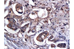 Formalin-fixed and paraffin embedded rat brain labeled with Anti-Caspase-9 Polyclonal Antibody, Unconjugated (ABIN724160) 1:200 followed by conjugation to the secondary antibody and DAB staining (Caspase 9 抗体  (AA 11-120))