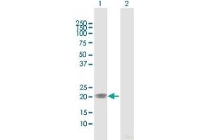 Western Blot analysis of MGMT expression in transfected 293T cell line by MGMT MaxPab polyclonal antibody. (MGMT 抗体  (AA 1-207))