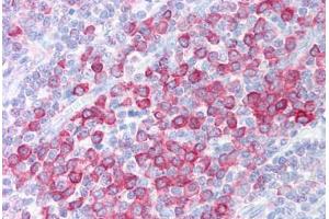 Human Tonsil (formalin-fixed, paraffin-embedded) stained with C1QTNF4 antibody ABIN213915 at 5 ug/ml followed by biotinylated goat anti-rabbit IgG secondary antibody ABIN481713, alkaline phosphatase-streptavidin and chromogen. (C1QTNF4 抗体  (C-Term))