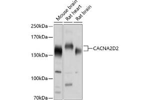 Western blot analysis of extracts of various cell lines, using CD2 antibody (ABIN6130178, ABIN6137811, ABIN6137812 and ABIN6214454) at 1:1000 dilution. (CACNA2D2 抗体  (AA 20-200))