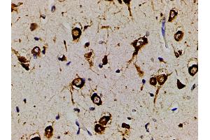 Immunohistochemistry (IHC) image for anti-Phosphoinositide 3 Kinase, p85 alpha (PI3K p85a) (pTyr607) antibody (ABIN6256775)