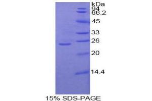 SDS-PAGE analysis of Human Protein Kinase C zeta Protein. (PKC zeta 蛋白)