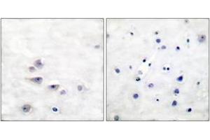 Immunohistochemistry analysis of paraffin-embedded human brain, using Shc (Phospho-Tyr427) Antibody. (SHC1 抗体  (pTyr427))
