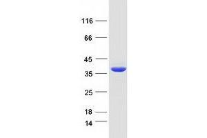 Validation with Western Blot (CFAP74/KIAA1751 Protein (Myc-DYKDDDDK Tag))