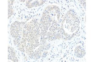 anti-RAP1 Interacting Factor Homolog (RIF1) (AA 1425-1450) antibody