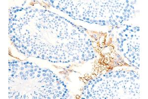 ABIN6267222 at 1/100 staining mouse testicular tissue sections by IHC-P. (CHEK1 抗体  (pSer286))