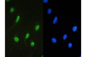 IF analysis of STAT1 using anti-STAT1 antibody (ABIN5518871) STAT1 was detected in immunocytochemical section of U20S cell.