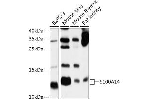 Western blot analysis of extracts of various cell lines, using S100 antibody (ABIN6128693, ABIN6147339, ABIN6147340 and ABIN6214636) at 1:1000 dilution. (S100A14 抗体  (AA 1-104))
