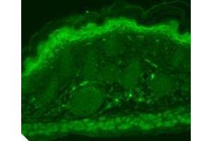 Immunofluorescence (IF) image for anti-Transient Receptor Potential Cation Channel, Subfamily V, Member 3 (TRPV3) (AA 774-791) antibody (ABIN361778)