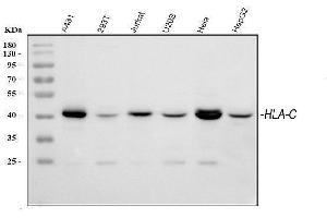 Western blot analysis of HLA-C using anti-HLA-C antibody (ABIN3043843).