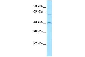 Host: Rabbit Target Name: MORN1 Sample Type: ACHN Whole Cell lysates Antibody Dilution: 1. (MORN1 抗体  (C-Term))
