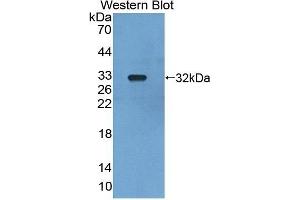 Detection of Recombinant LRDD, Mouse using Polyclonal Antibody to Leucine Rich Repeats And Death Domain Containing Protein (LRDD) (Leucine Rich Repeats And Death Domain Containing Protein (AA 666-915) 抗体)