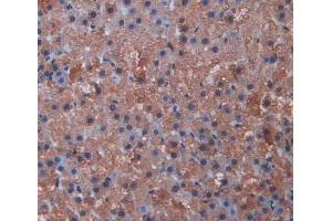 Immunohistochemistry (IHC) image for anti-Cytochrome P450, Family 11, Subfamily A, Polypeptide 1 (CYP11A1) (AA 392-521) antibody (ABIN7443572)