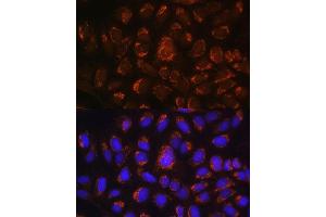Immunofluorescence analysis of U-2 OS cells using  antibody (ABIN6129884, ABIN6137152, ABIN6137153 and ABIN6214229) at dilution of 1:100. (ART1 抗体  (AA 23-295))