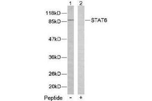 Image no. 2 for anti-Signal Transducer and Activator of Transcription 6, Interleukin-4 Induced (STAT6) (Thr645) antibody (ABIN197187) (STAT6 抗体  (Thr645))