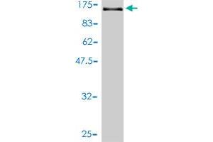 Western Blot detection against Immunogen (143 KDa) . (Vinculin 抗体  (AA 1-1066))