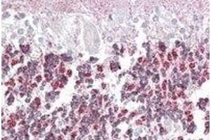 Immunohistochemistry (IHC) image for anti-Epilepsy, Progressive Myoclonus Type 2A, Lafora Disease (Laforin) (EPM2A) (Internal Region) antibody (ABIN2466629) (EPM2A 抗体  (Internal Region))