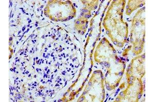 Immunohistochemistry of paraffin-embedded human kidney tissue using ABIN7164870 at dilution of 1:100 (PTGR2 抗体  (AA 206-282))