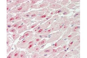 Immunohistochemistry (IHC) image for anti-Protein Phosphatase 1, Regulatory Subunit 13 Like (PPP1R13L) (AA 756-805) antibody (ABIN6755416)