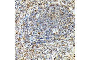 Immunohistochemistry of paraffin-embedded rat spleen using Phospho-VASP-S239 Rabbit pAb (ABIN3019748, ABIN3019749, ABIN3019750, ABIN1682137 and ABIN1682138) at dilution of 1:50 (40x lens). (VASP 抗体  (pSer239))