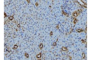 ABIN6279876 at 1/100 staining Mouse kidney tissue by IHC-P. (TRAPPC5 抗体  (Internal Region))