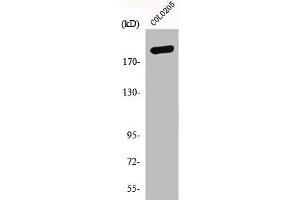 Western Blot analysis of COLO205 cells using GCP6 Polyclonal Antibody (GCP6 抗体  (Internal Region))