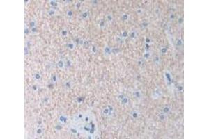 Used in DAB staining on fromalin fixed paraffin- embedded Kidney tissue (AIP 抗体  (AA 63-296))