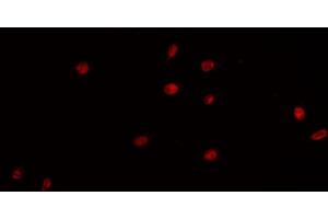 ABIN6266854 staining K-562 cells by IF/ICC. (PRKDC 抗体  (Internal Region))