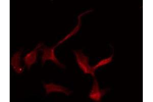 Immunofluorescence (fixed cells) (IF/ICC) image for anti-Solute Carrier Family 16 Member 2 (SLC16A2) (Internal Region) antibody (ABIN6258662)