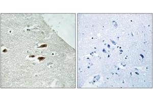 Immunohistochemistry analysis of paraffin-embedded human brain, using Period Circadian Protein 2 (Phospho-Ser662) Antibody. (PER2 抗体  (pSer662))
