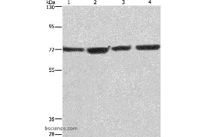 Western blot analysis of HUVEC, NIH/3T3, Hela and 293T cell, using KLF11 Polyclonal Antibody at dilution of 1:475 (KLF11 抗体)