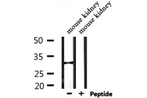 Western blot analysis of extracts from mouse kidney, using CBR1 Antibody. (CBR1 抗体  (C-Term))