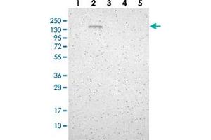 Western blot analysis of Lane 1: RT-4, Lane 2: U-251 MG, Lane 3: Human Plasma, Lane 4: Liver, Lane 5: Tonsil with GLG1 polyclonal antibody  at 1:250-1:500 dilution. (GLG1 抗体)