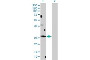 Western Blot analysis of BCL7B expression in transfected 293T cell line by BCL7B MaxPab polyclonal antibody. (BCL7B 抗体  (AA 1-202))