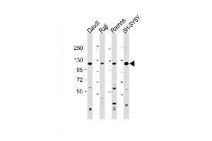 All lanes : Anti-LILRB1 Antibody (Center) at 1:500-1:2000 dilution Lane 1: Daudi whole cell lysate Lane 2: Raji whole cell lysate Lane 3: Ramos whole cell lysate Lane 4: SH-SY5Y whole cell lysate Lysates/proteins at 20 μg per lane. (LILRB1 抗体  (AA 345-374))